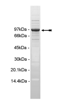 Eurofins DiscoverX PIP5K1 Protein, Active 10 &mu;g | Buy Online | Eurofins DiscoverX | Fisher Scientific